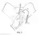 Fig. 06 - TRANSOBTURATOR SURGICAL ARTICLES AND METHODS