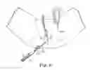 Fig. 07 - TRANSOBTURATOR SURGICAL ARTICLES AND METHODS