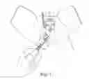 Fig. 08 - TRANSOBTURATOR SURGICAL ARTICLES AND METHODS