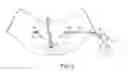 Fig. 09 - TRANSOBTURATOR SURGICAL ARTICLES AND METHODS