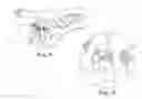 Fig. 10 - TRANSOBTURATOR SURGICAL ARTICLES AND METHODS