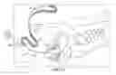 Fig. 11 - TRANSOBTURATOR SURGICAL ARTICLES AND METHODS