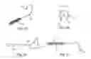 Fig. 15 - TRANSOBTURATOR SURGICAL ARTICLES AND METHODS