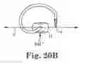 Fig. 17 - TRANSOBTURATOR SURGICAL ARTICLES AND METHODS