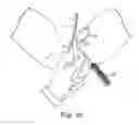Fig. 24 - TRANSOBTURATOR SURGICAL ARTICLES AND METHODS