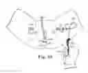 Fig. 27 - TRANSOBTURATOR SURGICAL ARTICLES AND METHODS