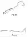 Fig. 28 - TRANSOBTURATOR SURGICAL ARTICLES AND METHODS
