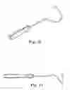 Fig. 31 - TRANSOBTURATOR SURGICAL ARTICLES AND METHODS