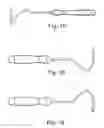 Fig. 32 - TRANSOBTURATOR SURGICAL ARTICLES AND METHODS