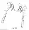 Fig. 34 - TRANSOBTURATOR SURGICAL ARTICLES AND METHODS