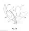 Fig. 12 - System for introducing soft tissue anchors