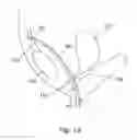 Fig. 13 - System for introducing soft tissue anchors