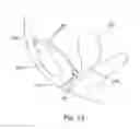 Fig. 14 - System for introducing soft tissue anchors