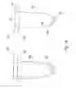 Fig. 15 - System for introducing soft tissue anchors