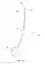 Fig. 16 - System for introducing soft tissue anchors
