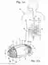 Fig. 02 - Encapsulated Medical Imaging Device and Method