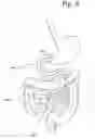 Fig. 07 - Encapsulated Medical Imaging Device and Method