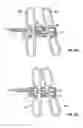 Fig. 11 - Shape-transferring cannula system and method of use