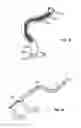 Fig. 16 - Shape-transferring cannula system and method of use