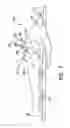 Fig. 02 - Surgical access system