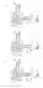 Fig. 04 - SELF CONTAINED ILLUMINATED INFUSION CANNULA SYSTEMS AND METHODS AND DEVICES