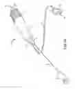 Fig. 12 - Multi-directional catheter control handle
