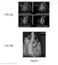 Fig. 10 - Extended interior methods and systems for spectral, optical, and photoacoustic imaging