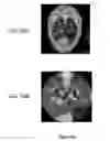 Fig. 11 - Extended interior methods and systems for spectral, optical, and photoacoustic imaging