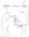 Fig. 01 - TECHNIQUES FOR REVIEWING AND ANALYZING IMPLANTABLE MEDICAL DEVICE SYSTEM DATA