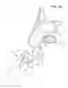 Fig. 09 - Methods and Systems for Delivery of Fluids and Aerosols to Tissue Surfaces, Cavities and Obstructed Passages such as Intranasal Ostia