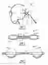 Fig. 02 - Recovery catheter assembly