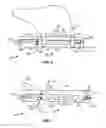 Fig. 07 - Recovery catheter assembly