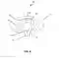 Fig. 06 - Deformable valve mechanism for controlling fluid delivery