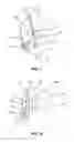 Fig. 07 - Deformable valve mechanism for controlling fluid delivery