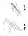 Fig. 06 - Systems and methods for gaining access around an implanted medical device