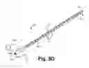 Fig. 15 - Systems and methods for gaining access around an implanted medical device