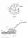 Fig. 07 - PROTECTIVE MEDICAL DEVICE AND METHOD OF USE THEROF