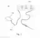 Fig. 02 - Brazed electrosurgical device