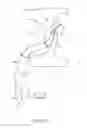 Fig. 03 - Welding systems useful for closure of cardiac openings