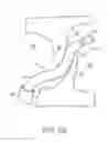 Fig. 04 - Welding systems useful for closure of cardiac openings