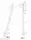 Fig. 02 - Pediatric intramedullary nail