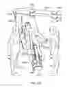Fig. 40 - Surgical system counterbalance