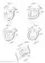 Fig. 09 - Surgical instruments with flexible member attachment structures