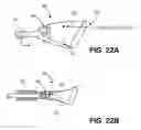 Fig. 22 - Intravascular blood filters and methods of use