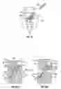 Fig. 07 - Distraction screw