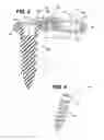 Fig. 03 - Bone fixation plate assembly