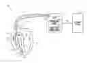 Fig. 01 - Implantable cardioverter defibrillator with programmable capacitor charging level