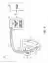 Fig. 02 - Implantable cardioverter defibrillator with programmable capacitor charging level