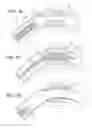 Fig. 02 - BIODEGRADABLE COMPOSITE STENT