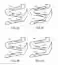 Fig. 09 - BIODEGRADABLE COMPOSITE STENT
